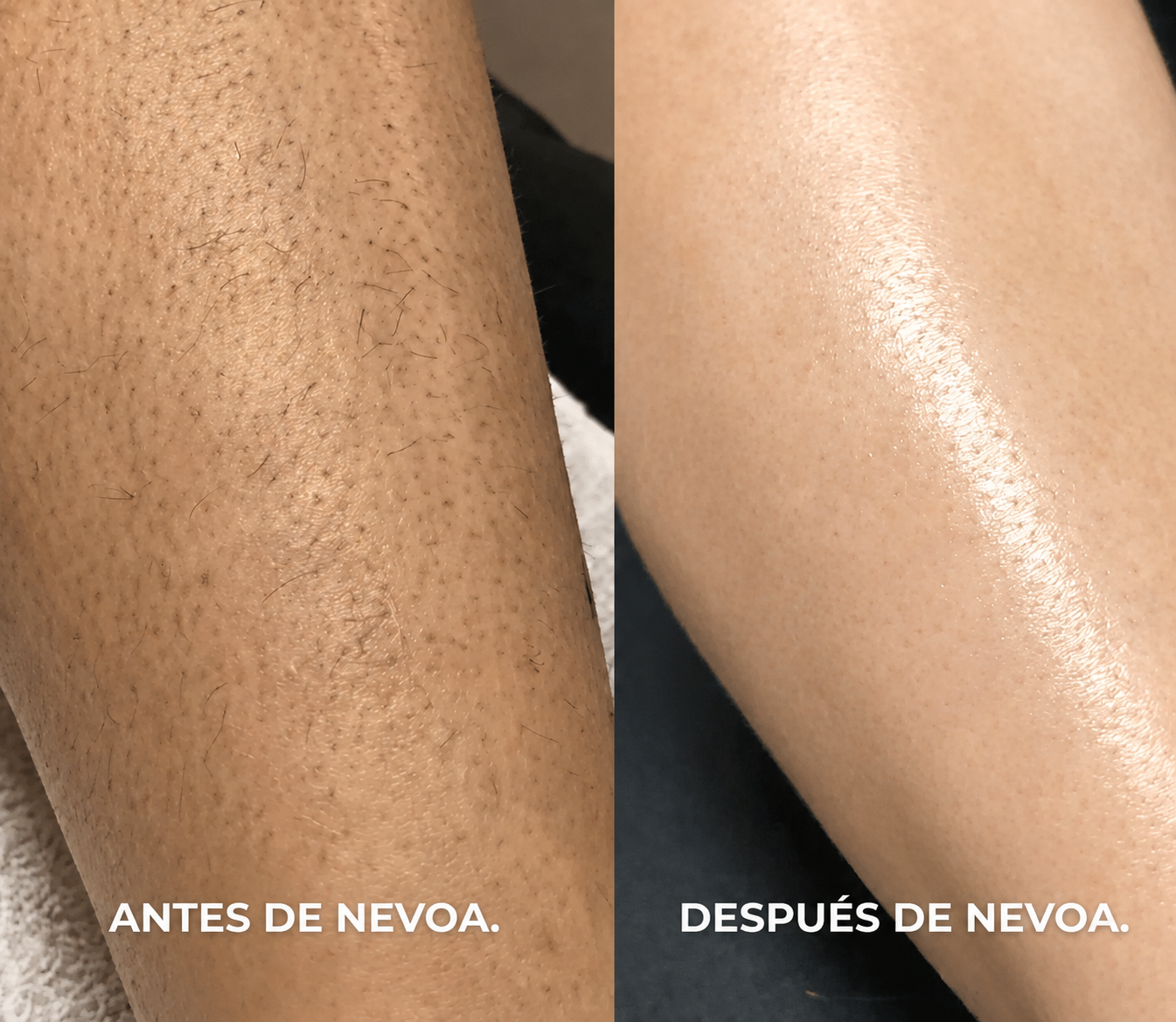 Depiladora 2 en 1